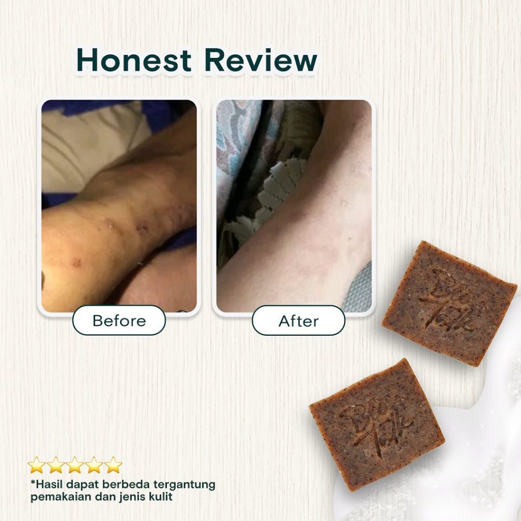 Before-After Coffee scrub5
