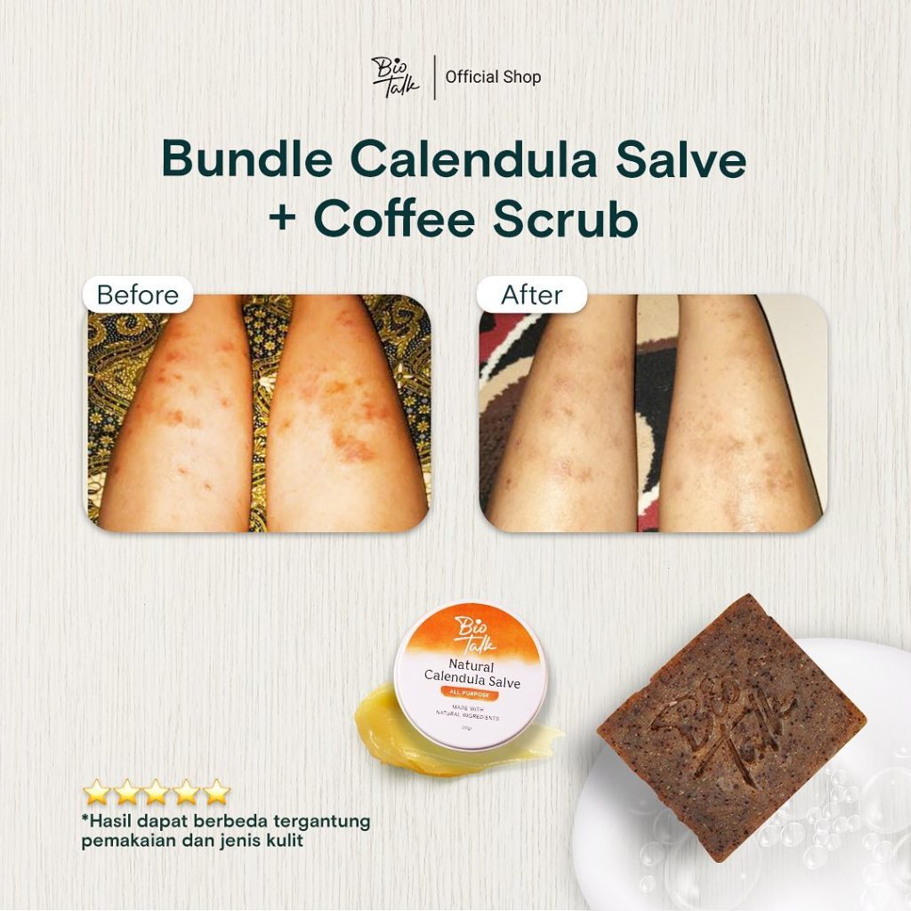 Before-After Bundle Bekas Luka1