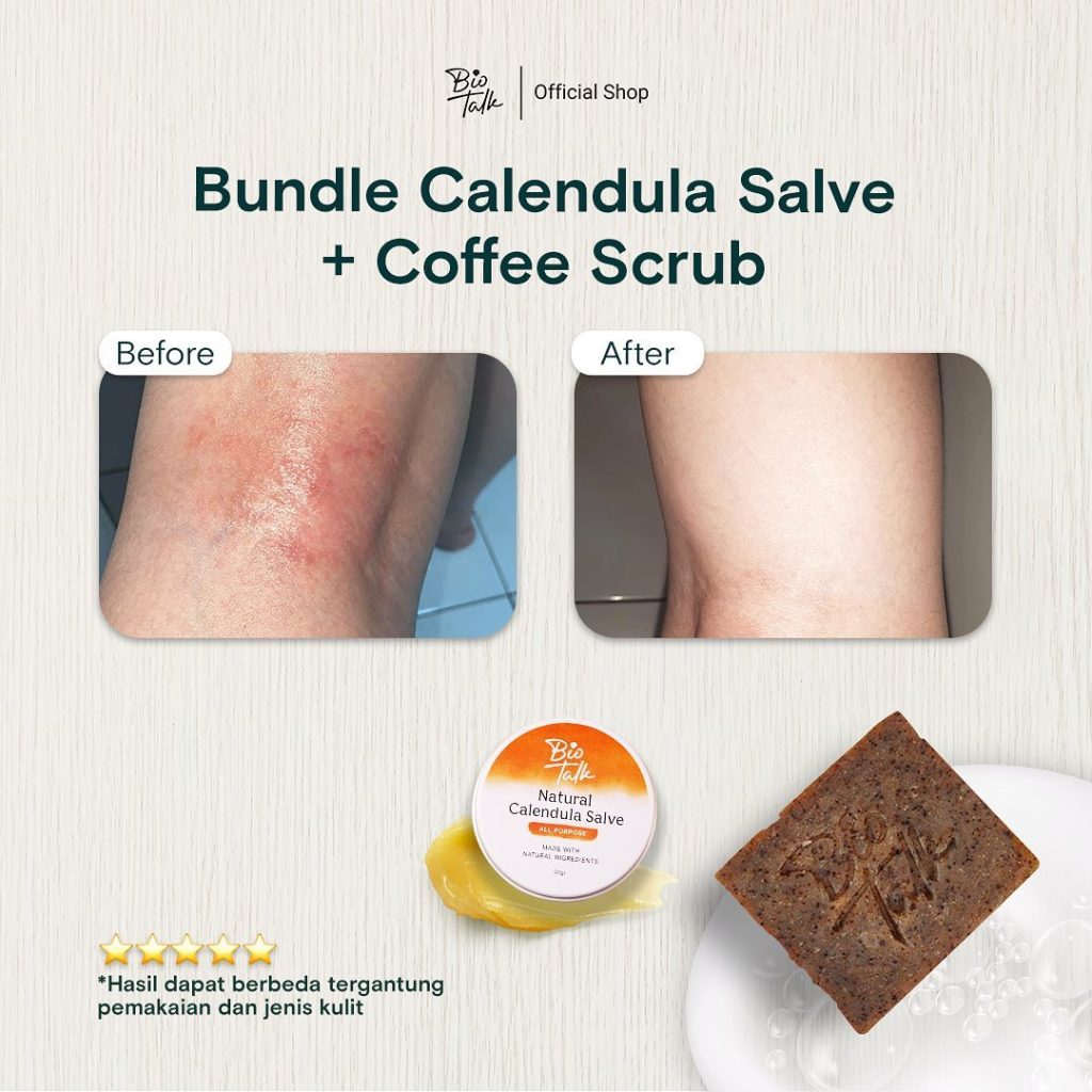 Before-After Bundle Bekas Luka3