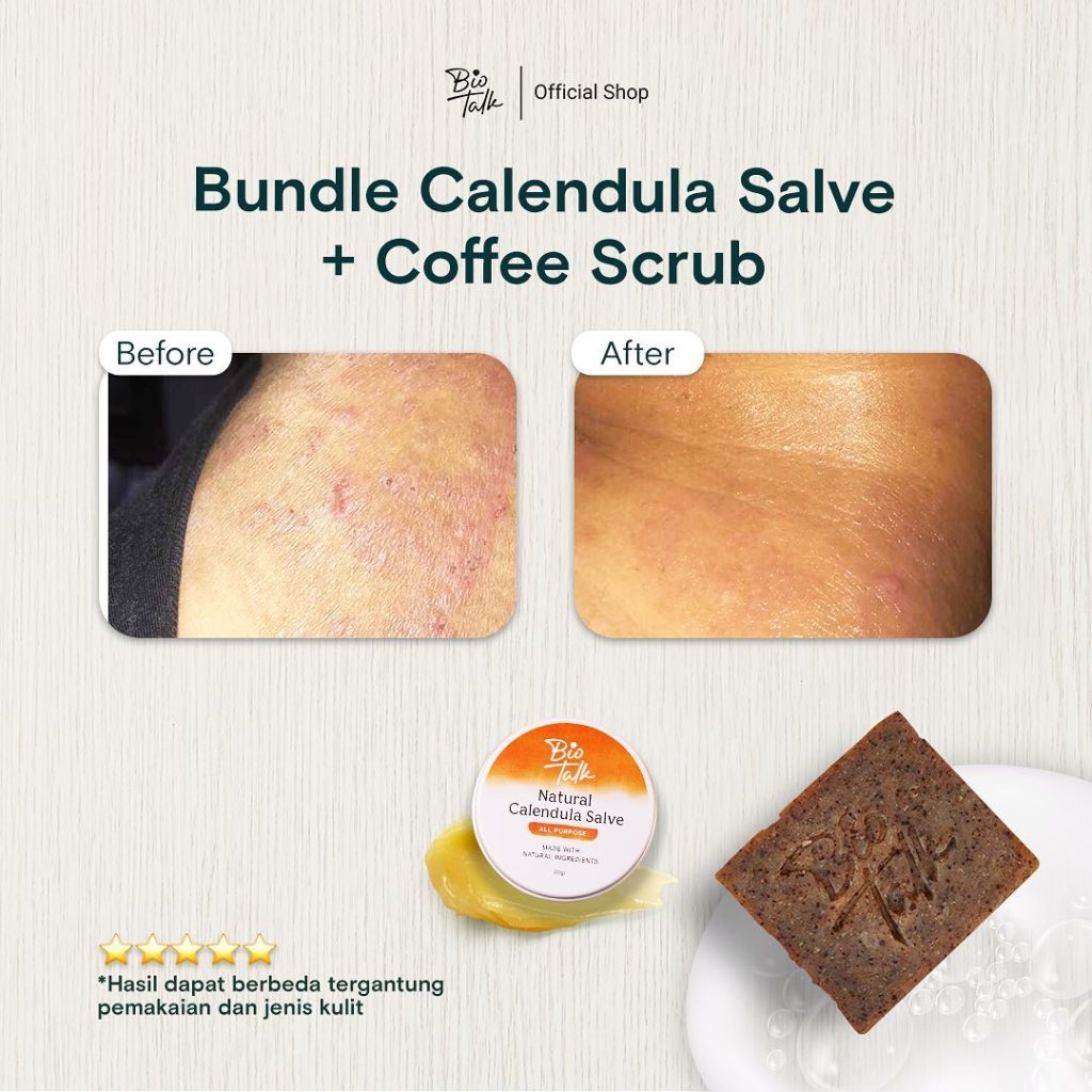 Before-After Bundle Bekas Luka5
