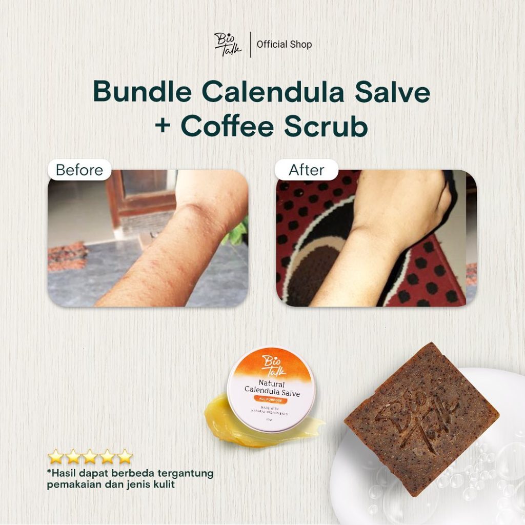 Before-After Bundle Bekas Luka6