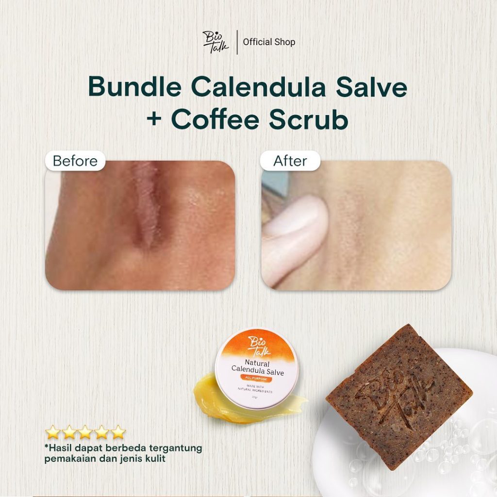 Before-After Bundle Bekas Luka7