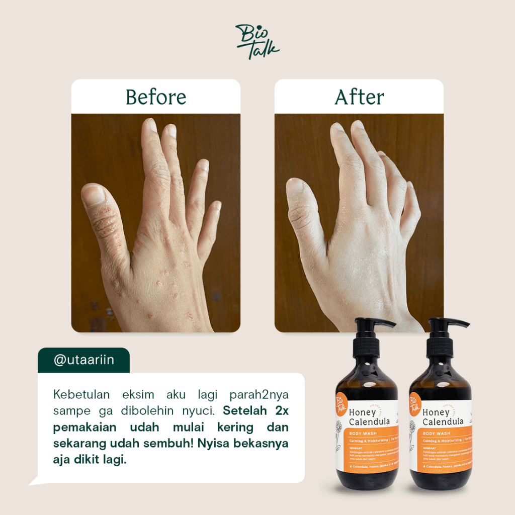 e-3-honeycalen-testimoni