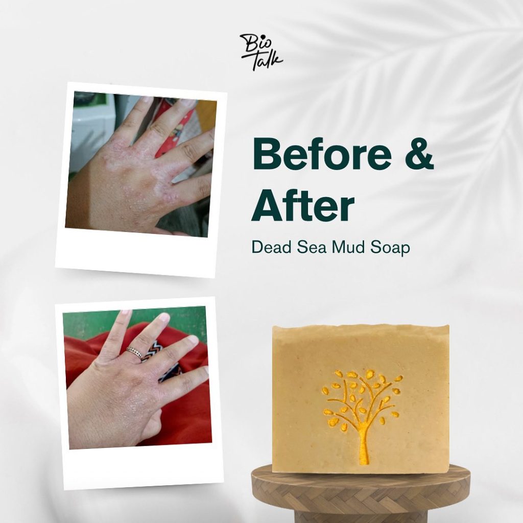 Dead Sea Mud_Before:after-3