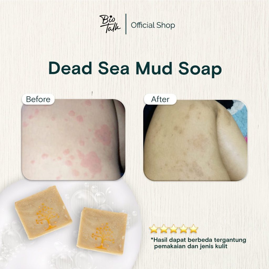 Dead Sea Mud_Before:after-5