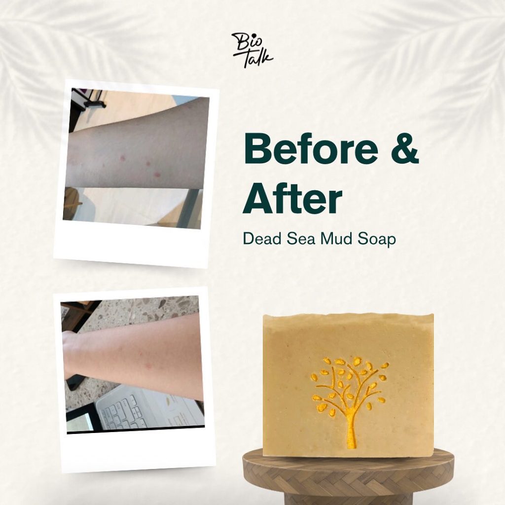 Dead Sea Mud_Before:after-6
