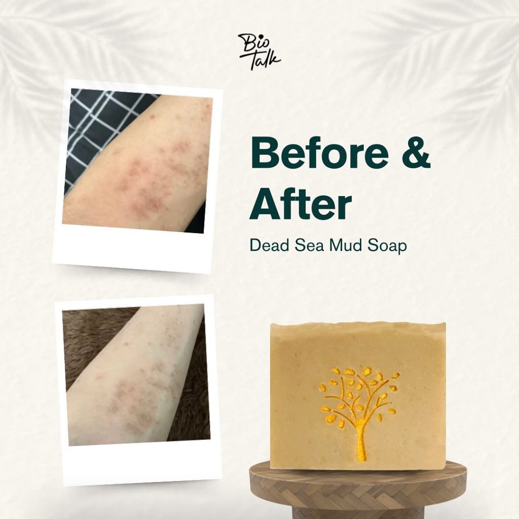 Dead Sea Mud_Before:after-7