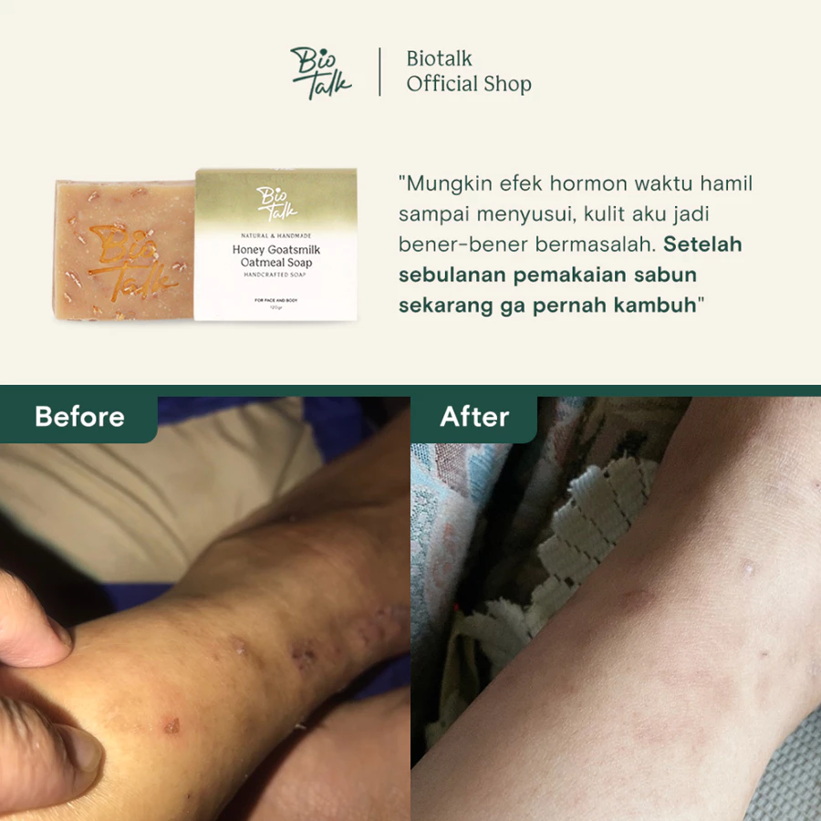 Honey Goays Milk_Before:after-3