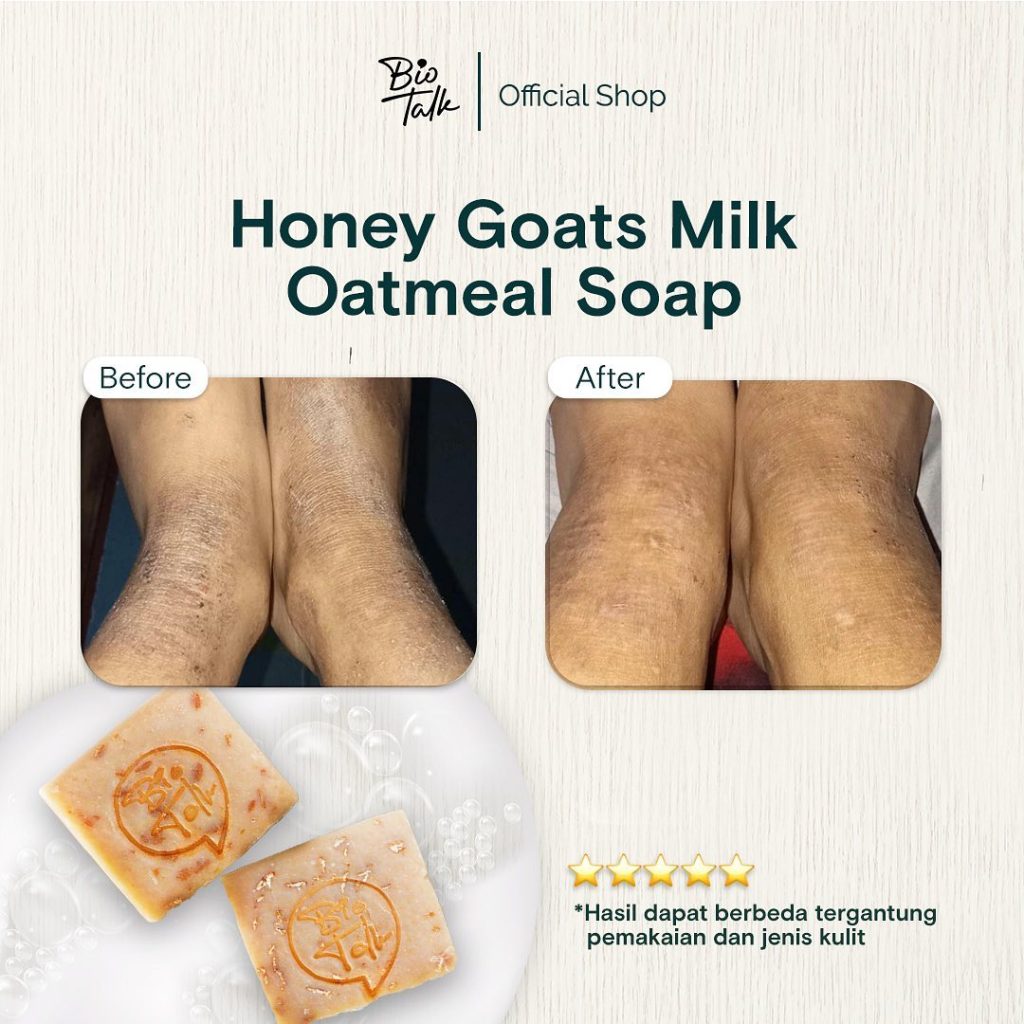 Honey Goays Milk_Before:after-6