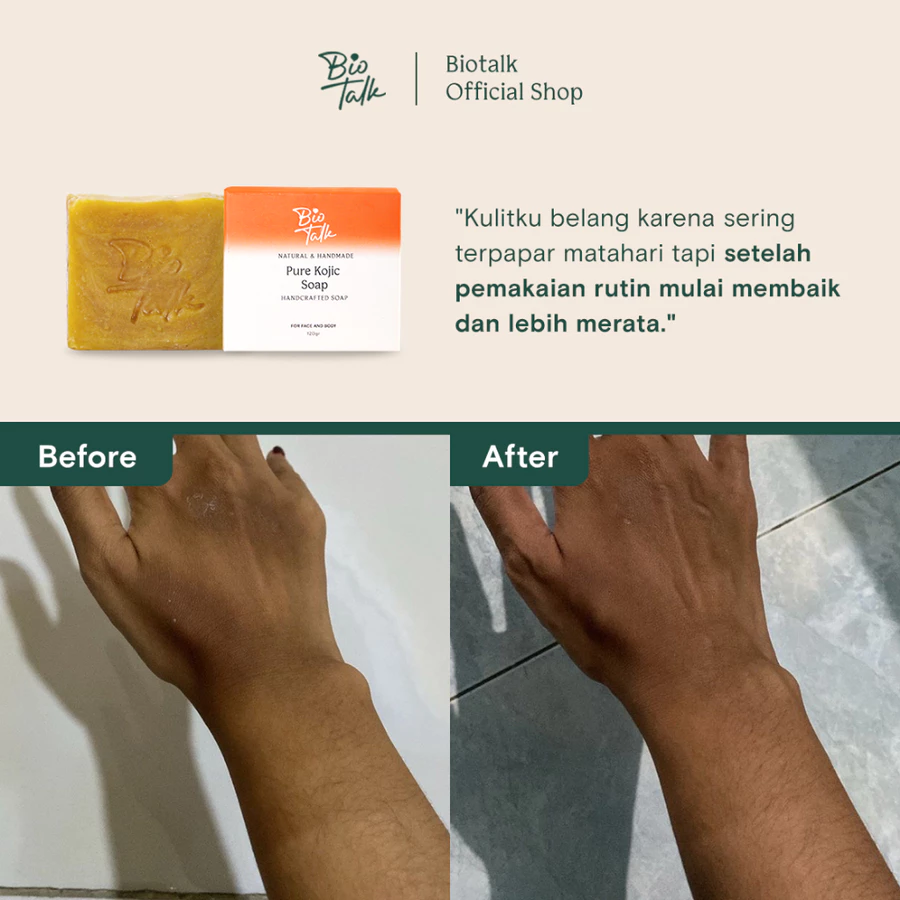 Kojic_Before:after-1