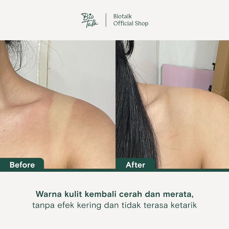 Kojic_Before:after-2