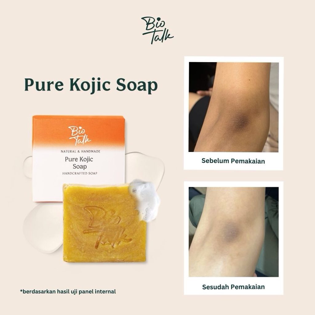 Kojic_Before:after-4