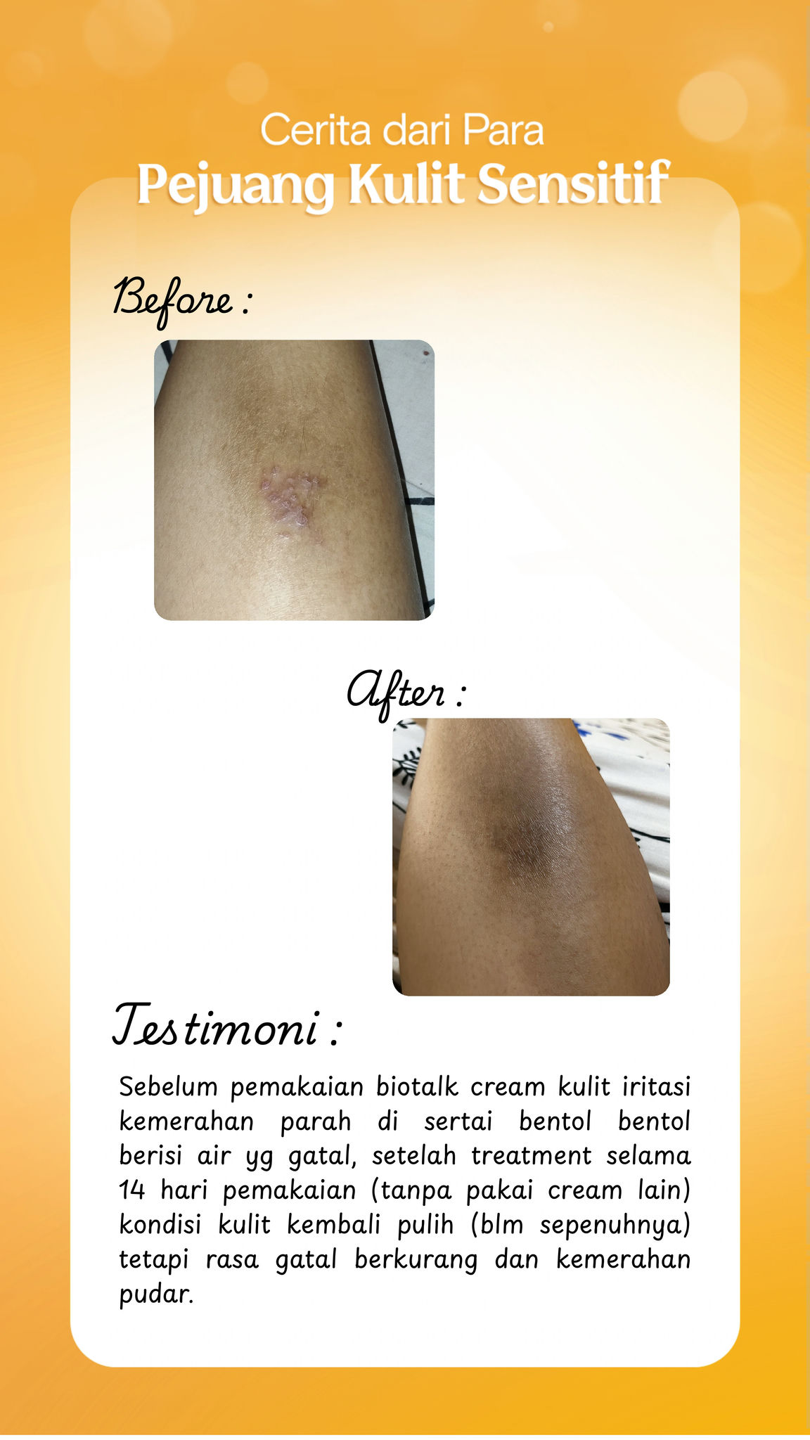 Before-page-03---880bf478-b27b-4683-a8fb-39c8d7a5cd5f